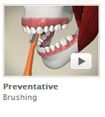 Preventative Brushing